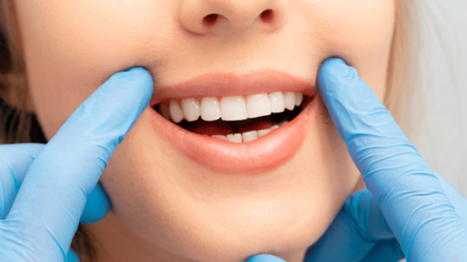 Experience Advanced Smile Care at Bliss White Dental Studio – Top Dentist in HSR Layout for Expert Care