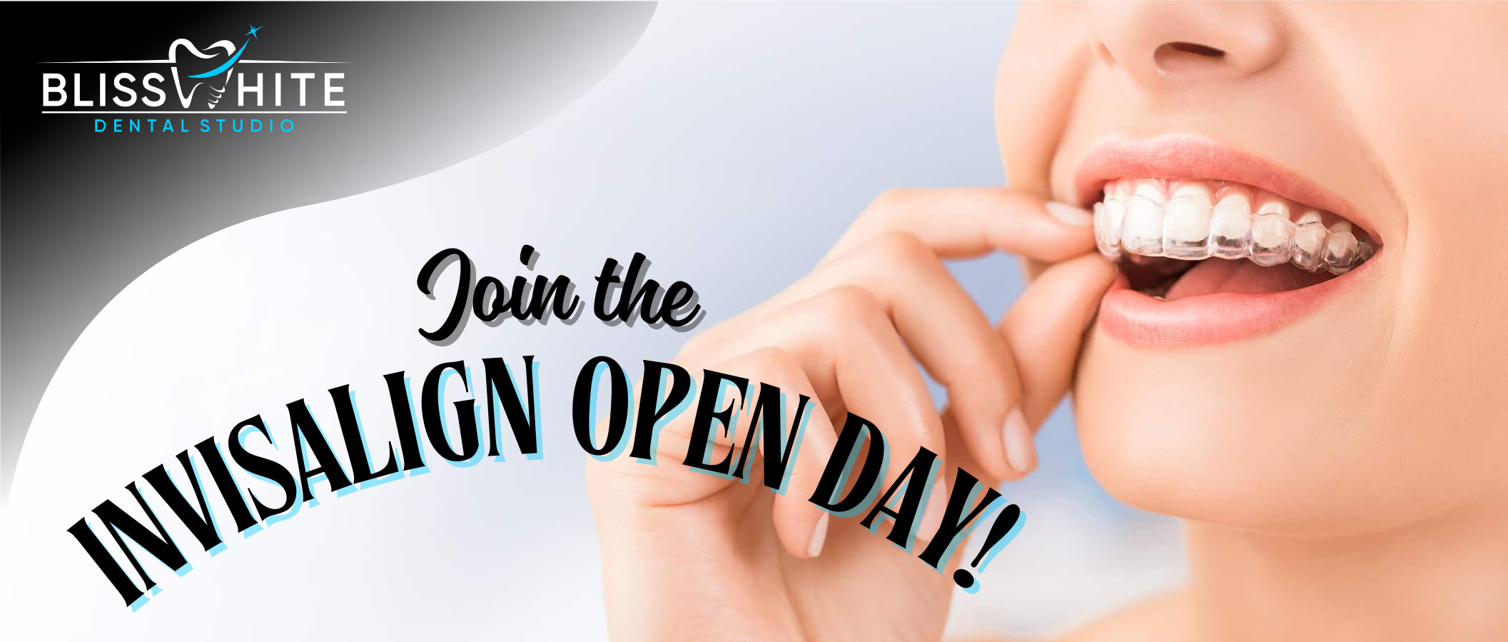 Invisalign Treatment in HSR Layout – Benefits of Invisalign Open Day