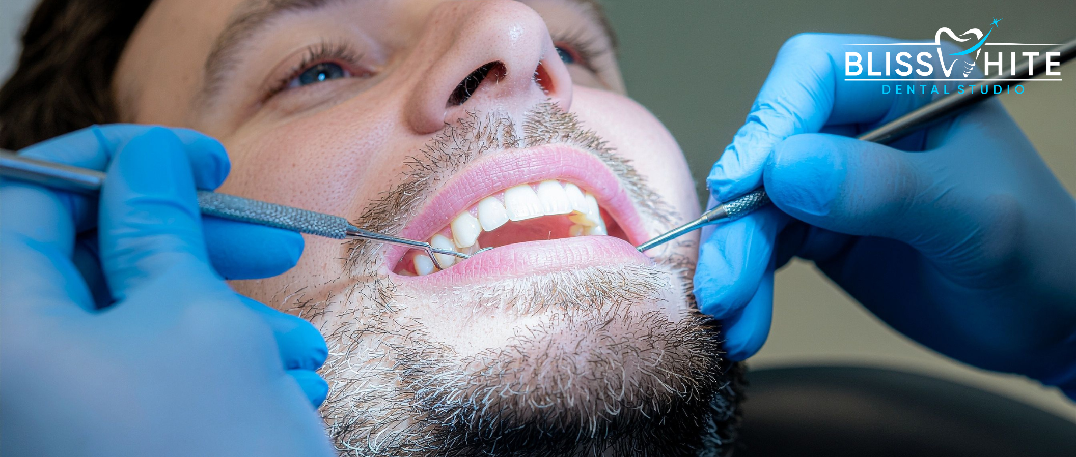 Biomimetic Dentistry in Bangalore: The Future of Natural, Tooth-Preserving Dental Care