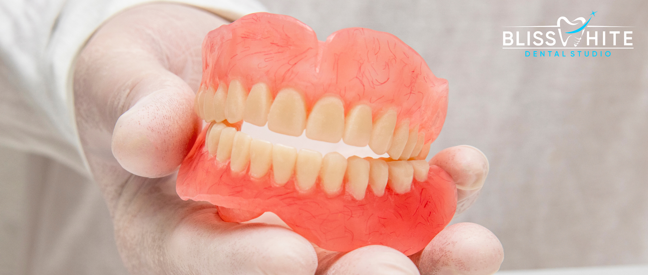 Implant Supported Dentures in Bangalore: Cost, Benefits & Best Treatment for Missing Teeth