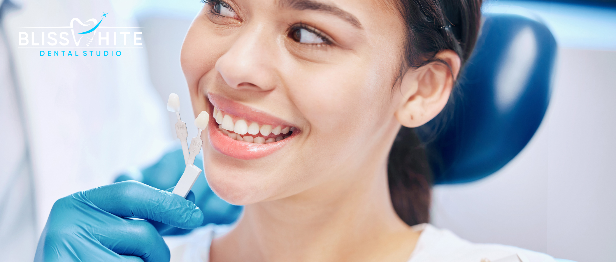 How Much Do Porcelain Veneers Cost in Bangalore? A Complete Guide