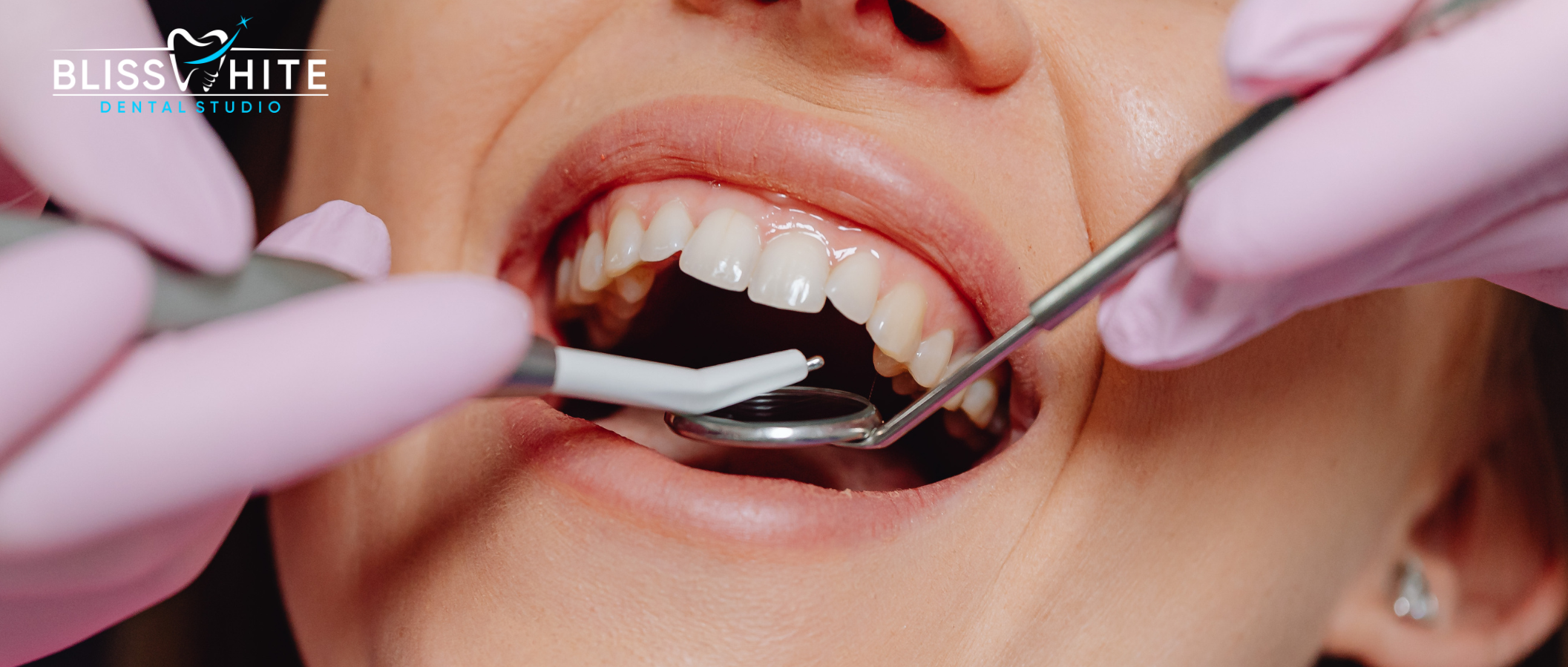 Cosmetic Dentistry in Bangalore: Cost, Treatments, Benefits & Best Cosmetic Dentist Guide